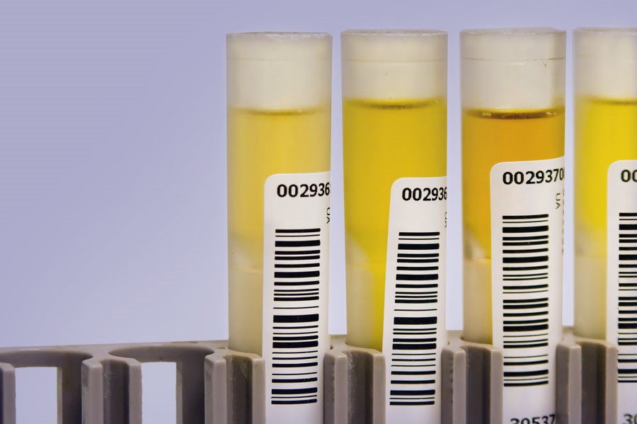 Synthetic Urine To Pass Drug Test Edson KS 67733